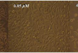 The upper panel shows microscopic photographs of the MCF-7 cancer cells in the absence (C) and presence of different concentrations of the Ni(II) complex (indicated by the number inside each photo). 